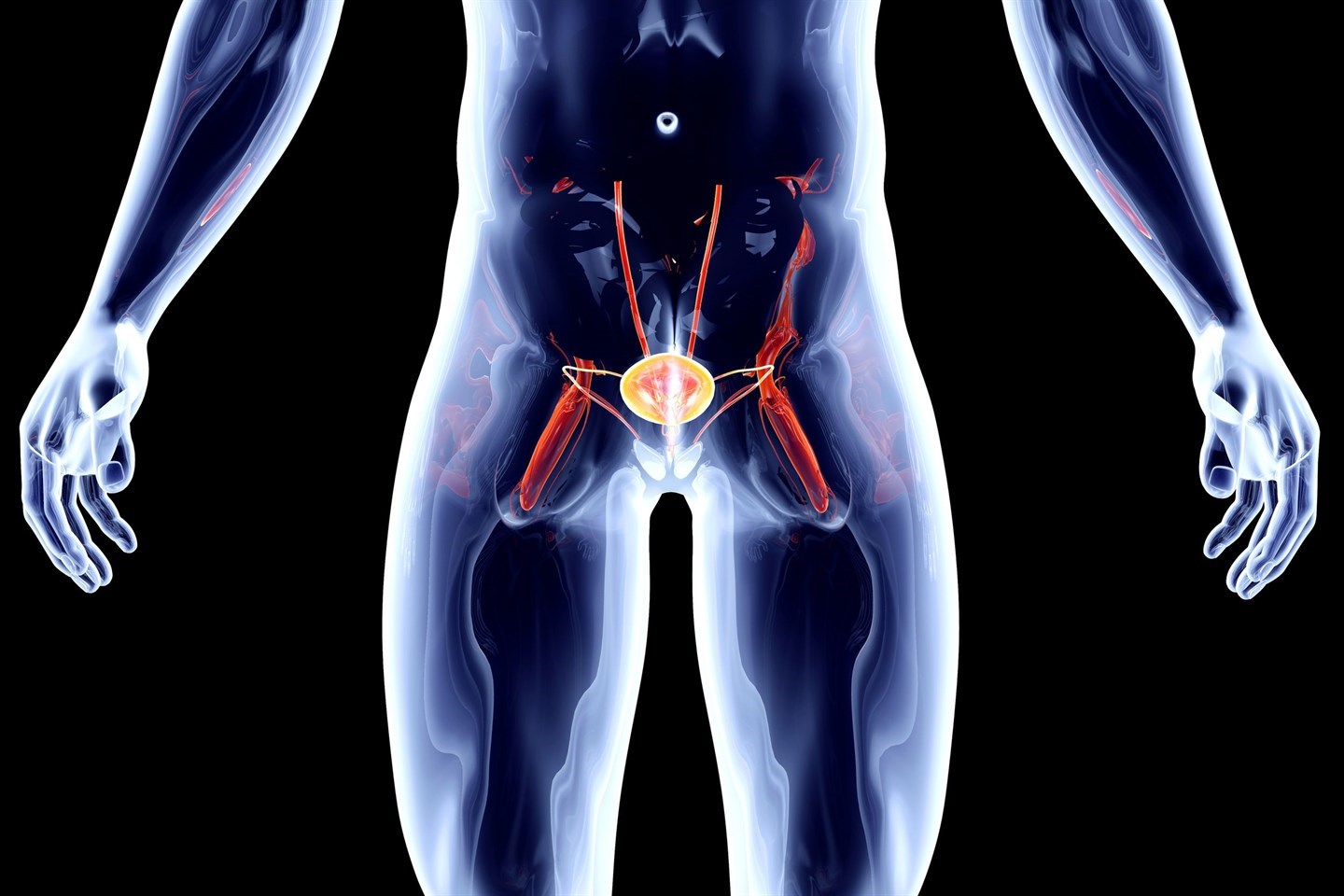 Рак предстательной железы (опухоль) у мужчин: симптомы и причины