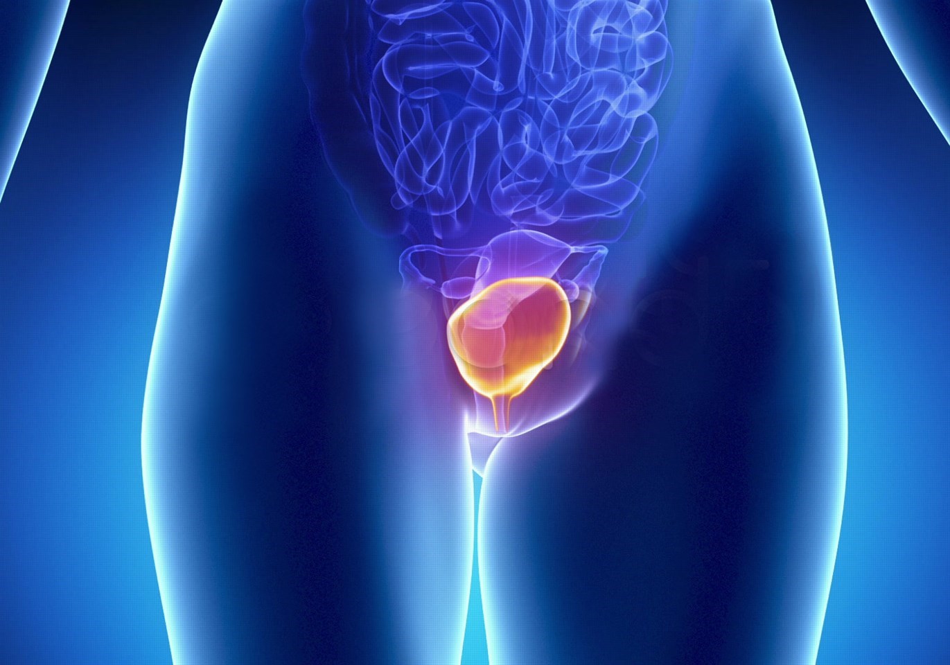 Склероз шейки мочевого пузыря: симптомы и лечение