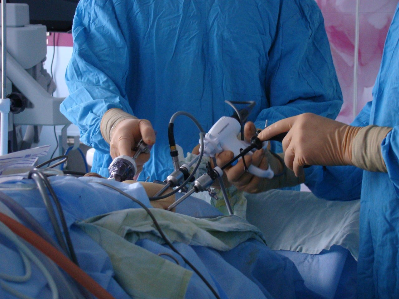 Лапароскопическая радикальная простатэктомия