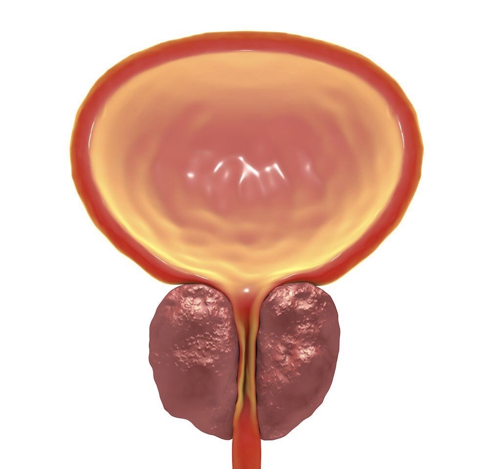 Хронический простатит: симптомы и причины
