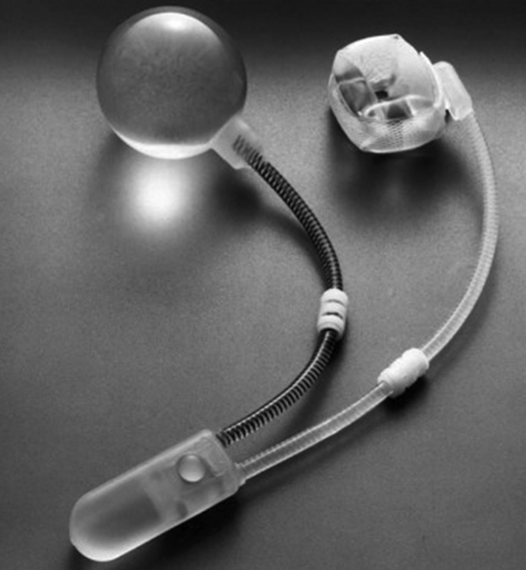 Искусственный сфинктер мочевого пузыря