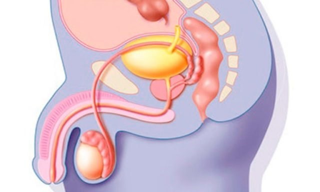 Меатостеноз (сужение наружного отверстия уретры): симптомы и причины